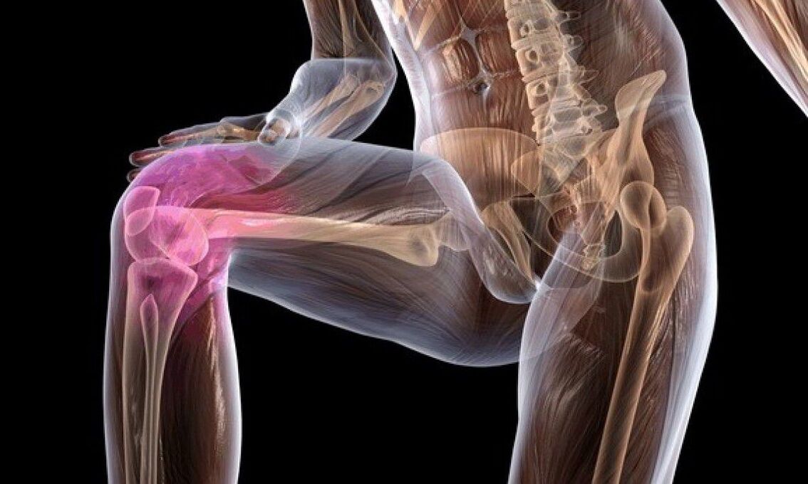 symptoms of joint pain