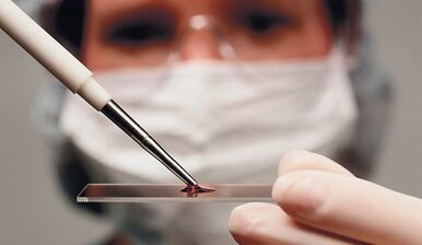 Differential diagnosis of attributes and arthrosis