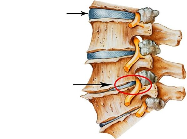 Disorders in interface dies