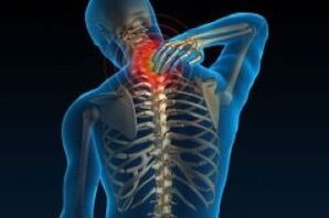 Cervical osteochondrose leads to hurt in neck